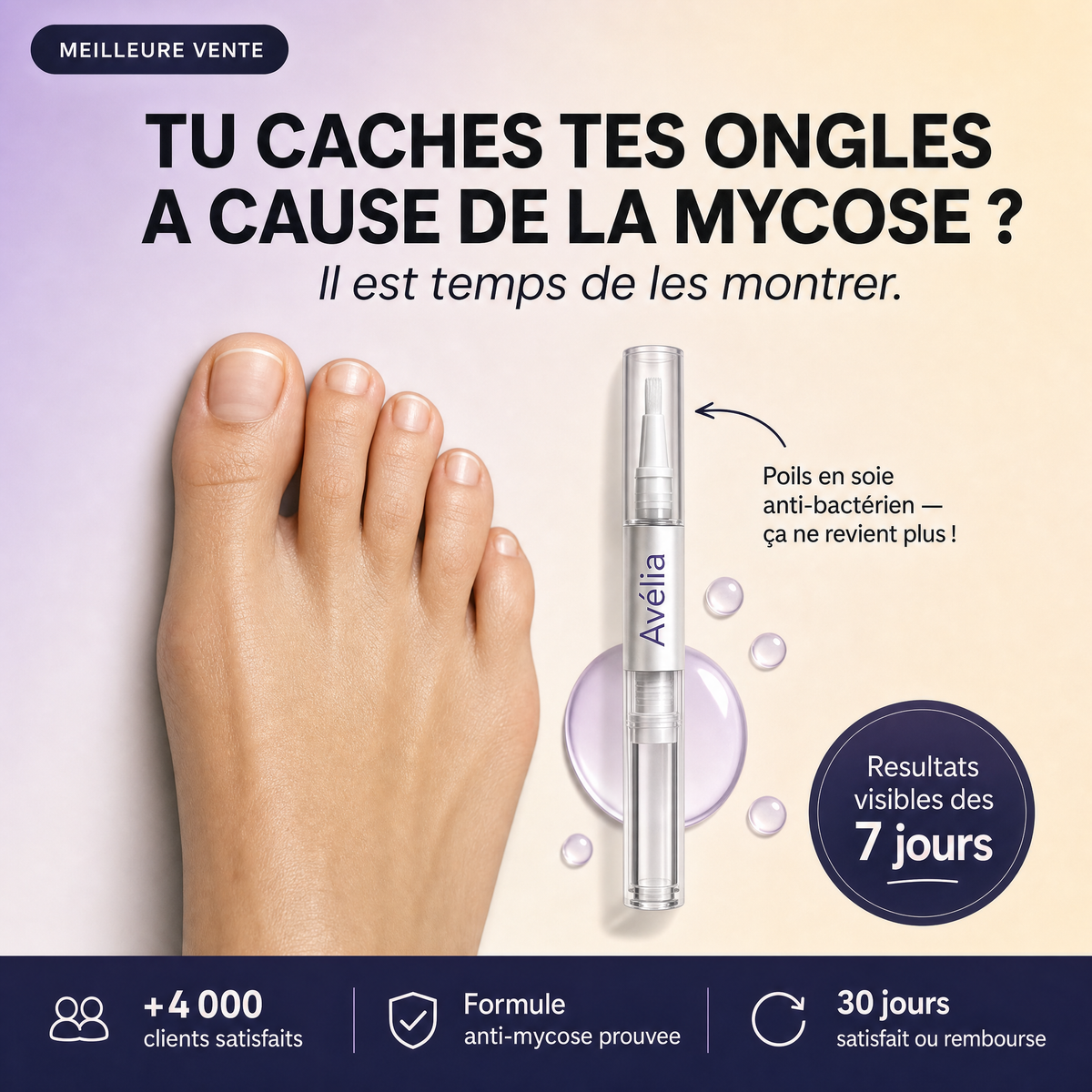 Mycose des ongles : traitement rapide pour oser enlever ses chaussures | Avélia
